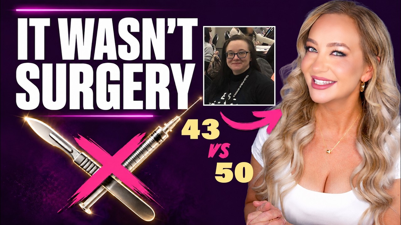 Prettier at 50: Everyone Swears I Had Surgery (What I Really Did)