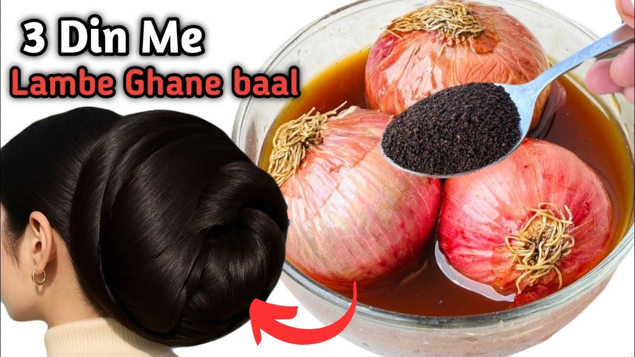 Black Tea & Onion For 10x Faster Hair Growth Remedy✨️Chai Patti Me Ye Mix Kare Baal 100% Lambe Ghane