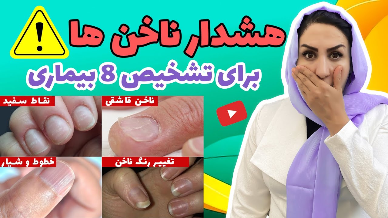 8 علامت هشداردهنده ناخن ها در مورد بیماری ها | از علائم ناخن هات بیماری هاتو تشخیص بده!