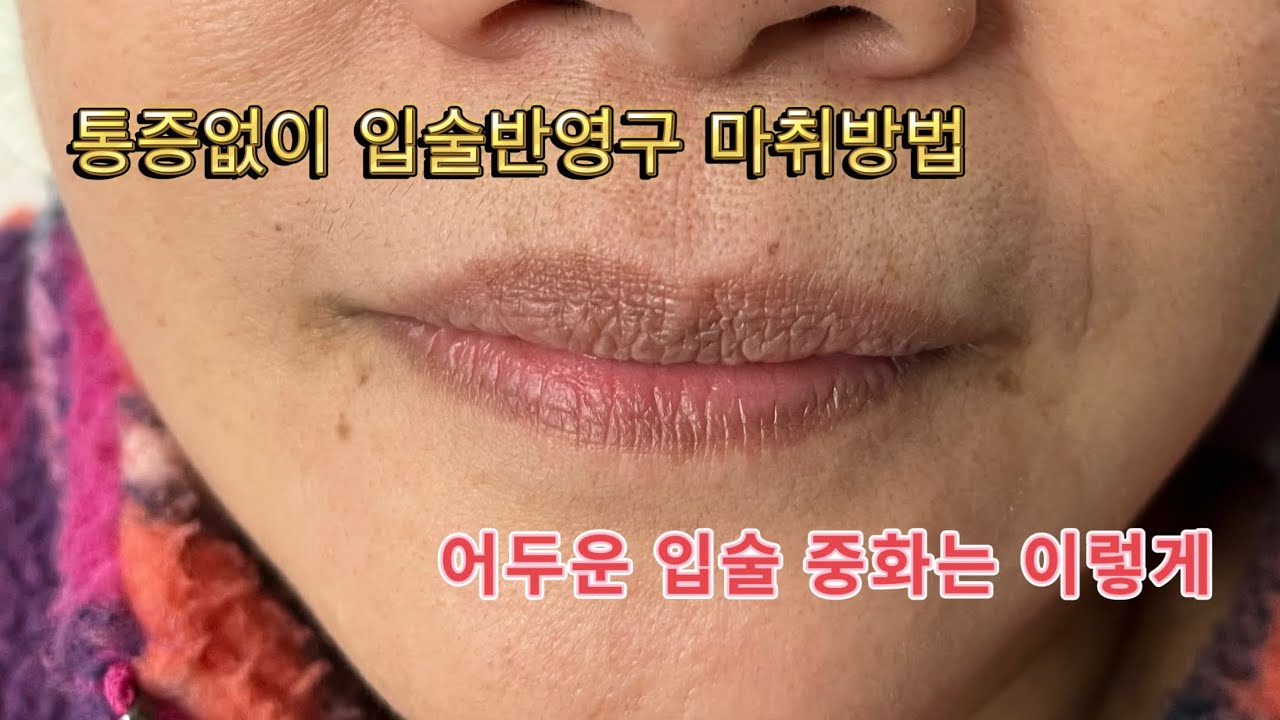 통증없이 입술 반영구 마취방법! 어두운 입술 중화방법