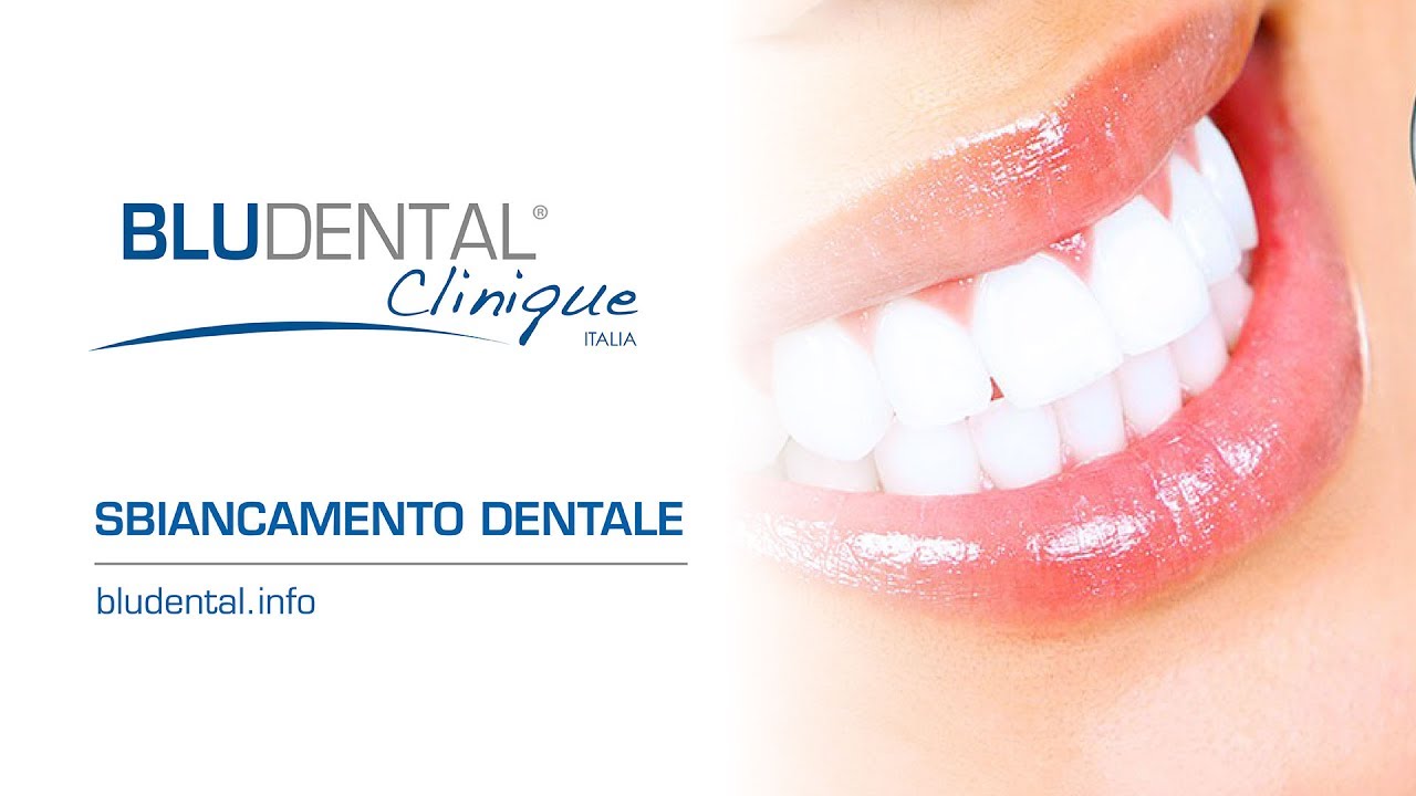 SBIANCAMENTO DEI DENTI