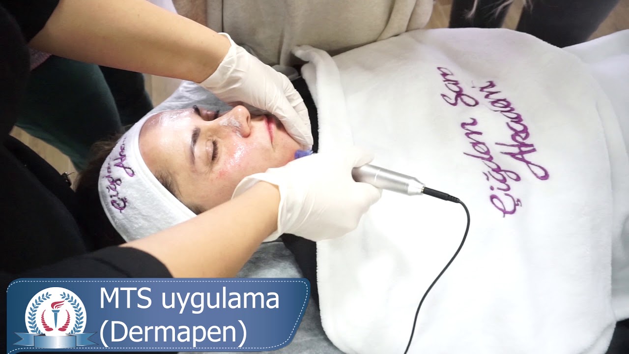 MTS Dermapen Nasıl Uygulanır ? Nedir?  BB Glow Kalıcı Fondöten
