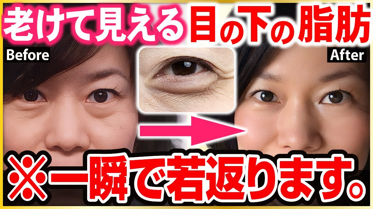 【目の下のブヨブヨ脂肪】1週間で消える！すっきり目元になる魔法の「眼輪筋ストレッチ」