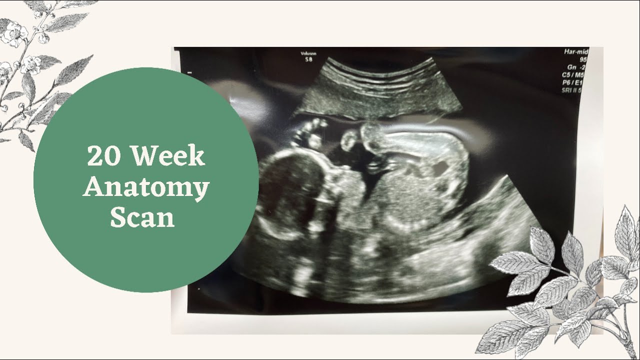 20 Week Anatomy Scan | Boy Mom Vlog