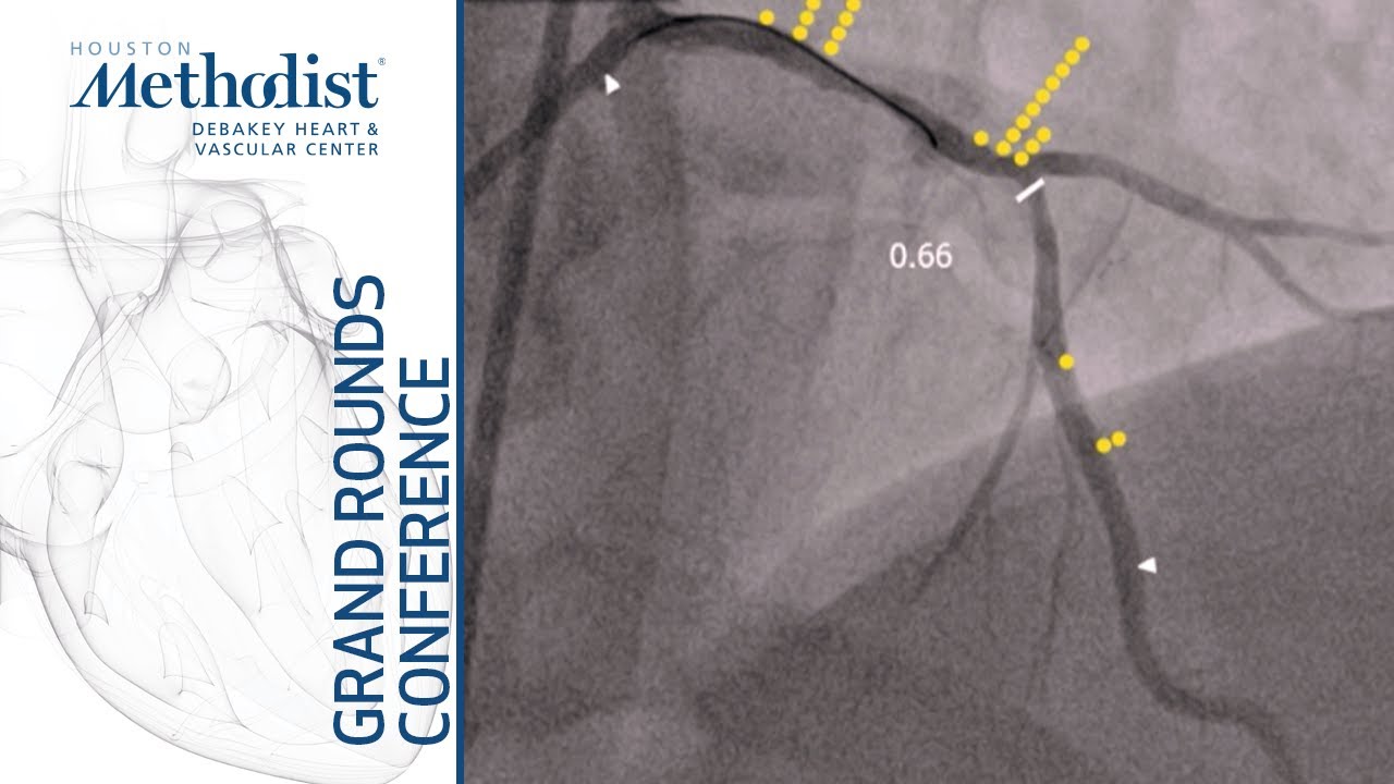 Interventional Cardiology (Neal S. Kleiman, MD) November 21, 2019 LIVESTREAM RECORDING