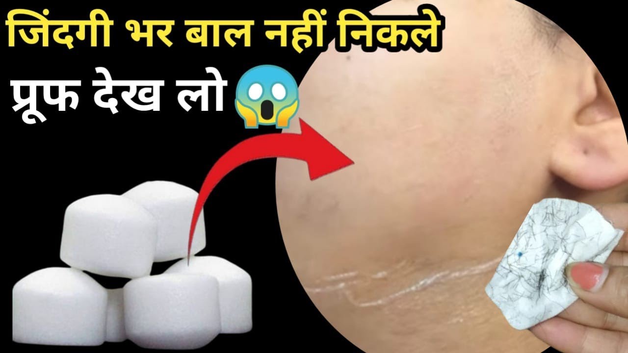 कपूर में इसे मिलाकर लगा लो😱बिना दर्द चेहरे के बाल ऐसे साफ जैसे था ही नहीं || facial hair removal 