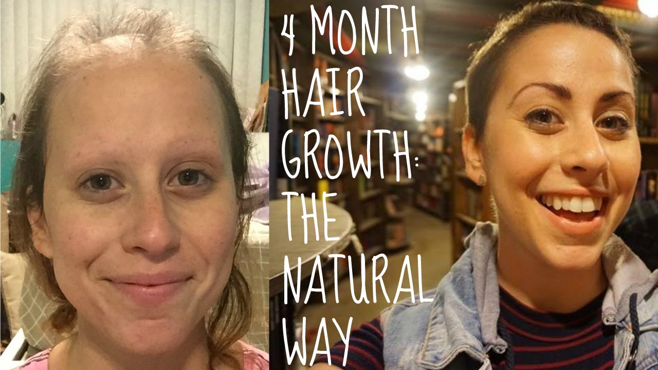 How I Am Speeding Up Hair Growth After Chemo NATURALLY!