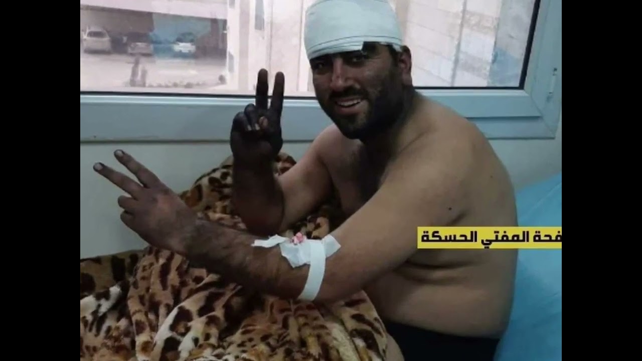 Hesek&ecirc; derg&ucirc;şa j&icirc;n&ecirc; / koma Z&icirc;lan