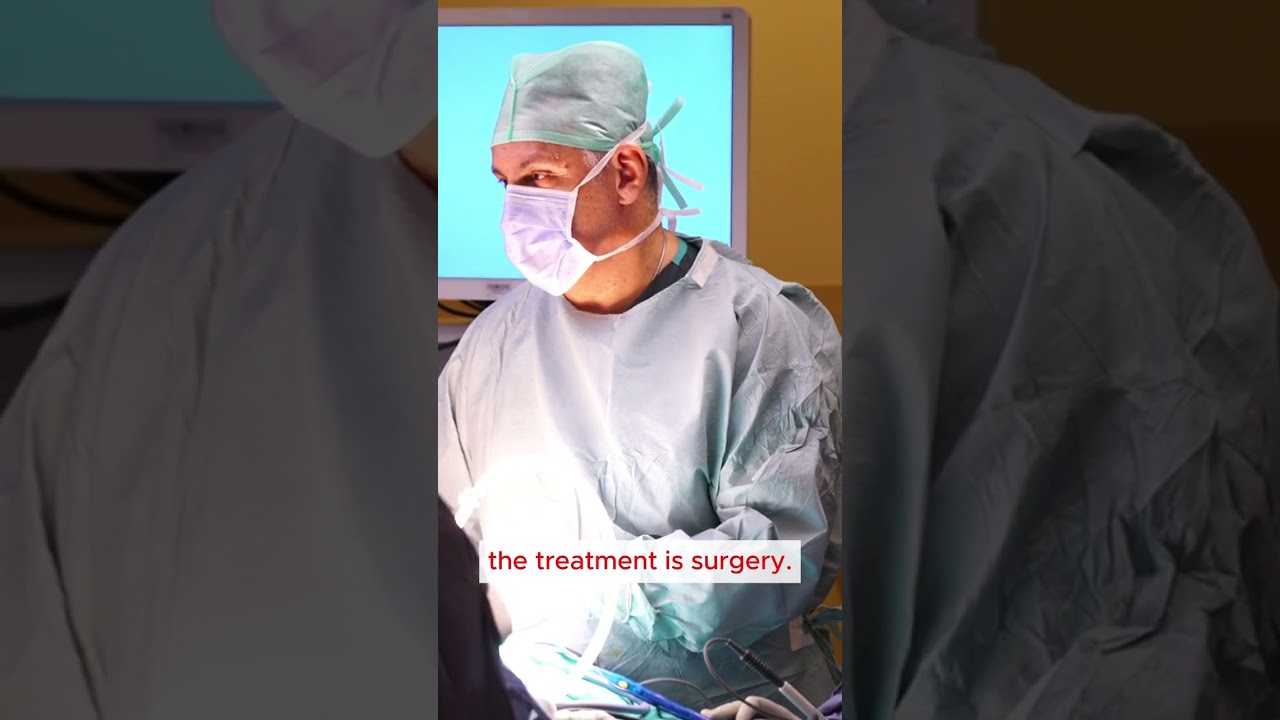 Solution to gallbladder stones with minimally invasive laparoscopic treatment!