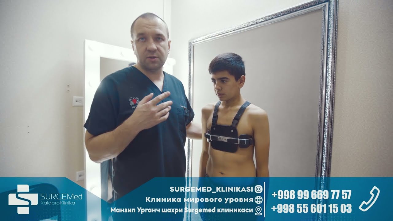 Килевидная деформация грудной клетки