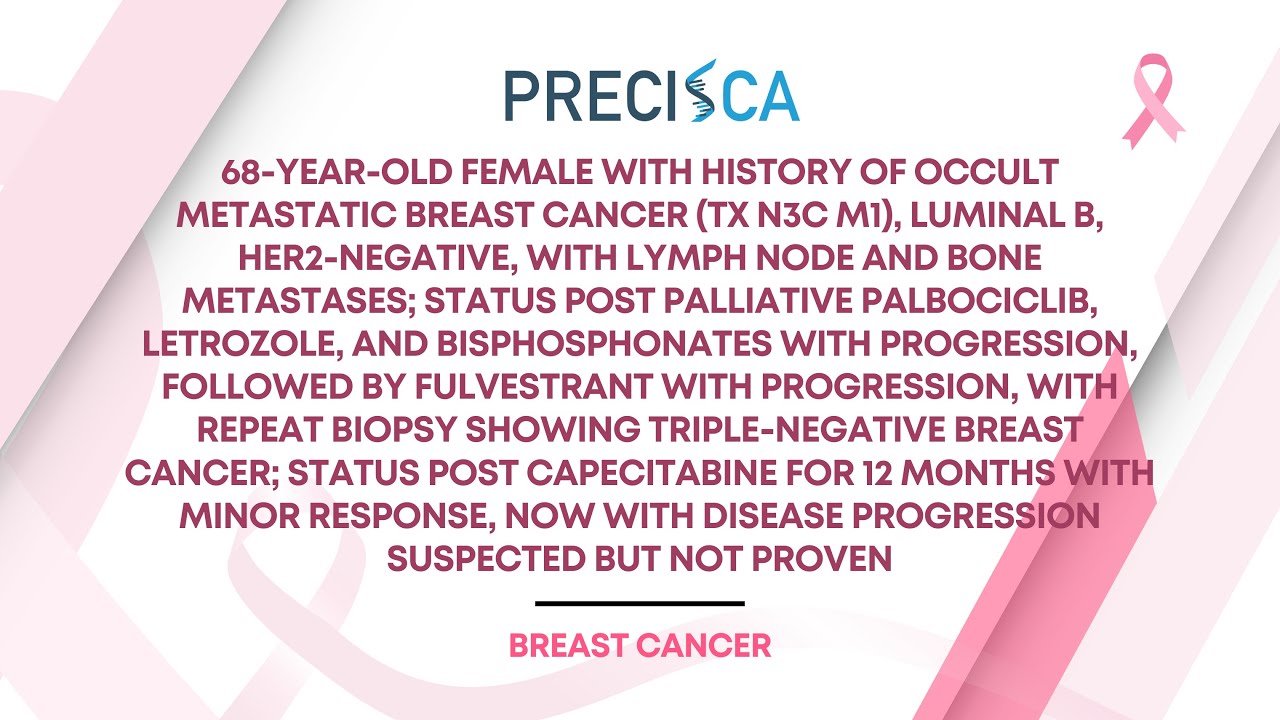 Expert Cancer Panel: Multiply recurrent, occult, luminal B MBC w/ likely progression on capecitabine