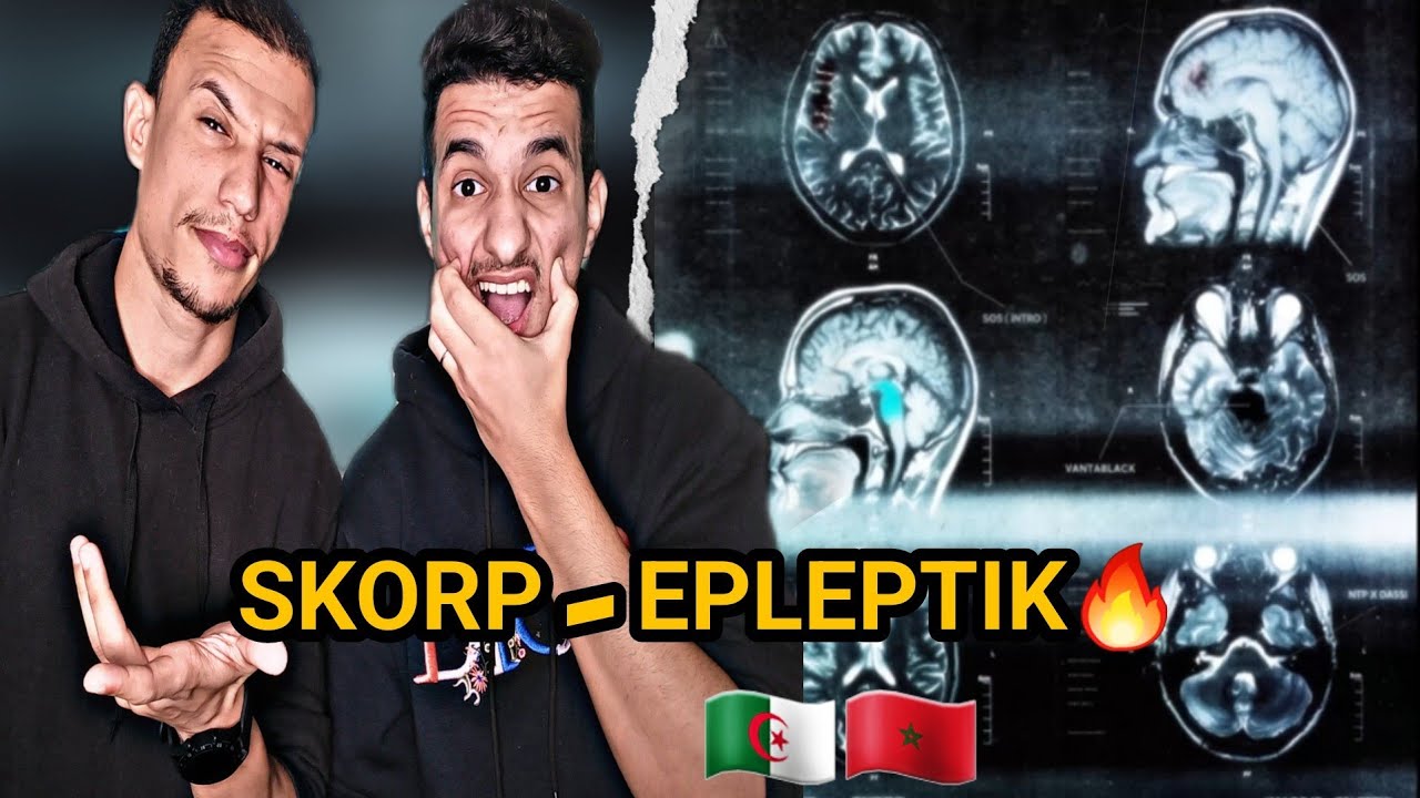 SKORP - EPLEPTIK (REACTION) PART1 🇲🇦🇩🇿 WHAATT!