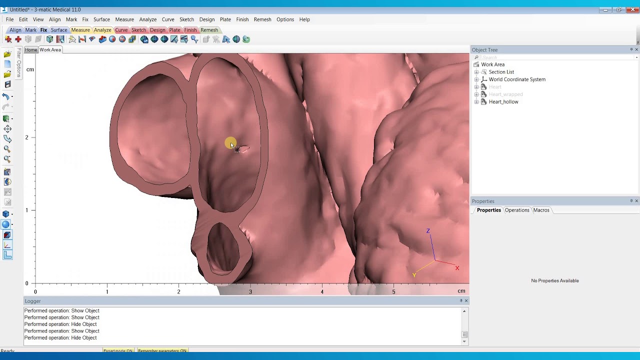 How to Eliminate Holes in Your 3D Models in 3-matic | Mimics Innovation Suite | Materialise Medical