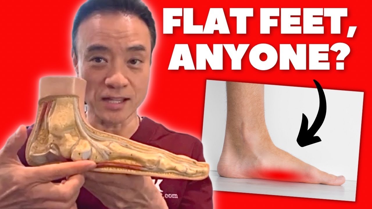 How To Fix Flat Feet With Insoles/Orthotics
