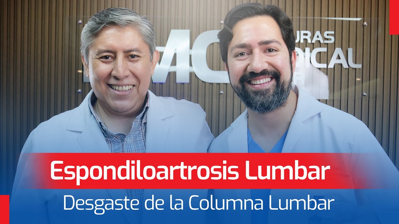 Espondiloartrosis Lumbar: Desgaste de la Columna Lumbar