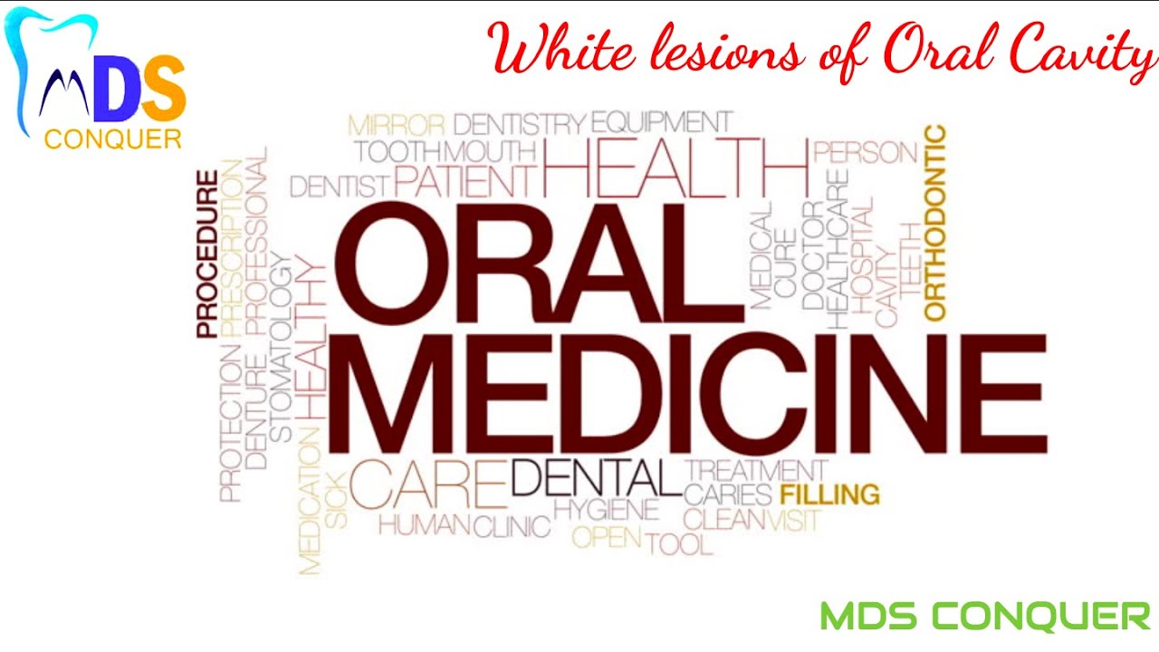 White lesions of oral cavity
