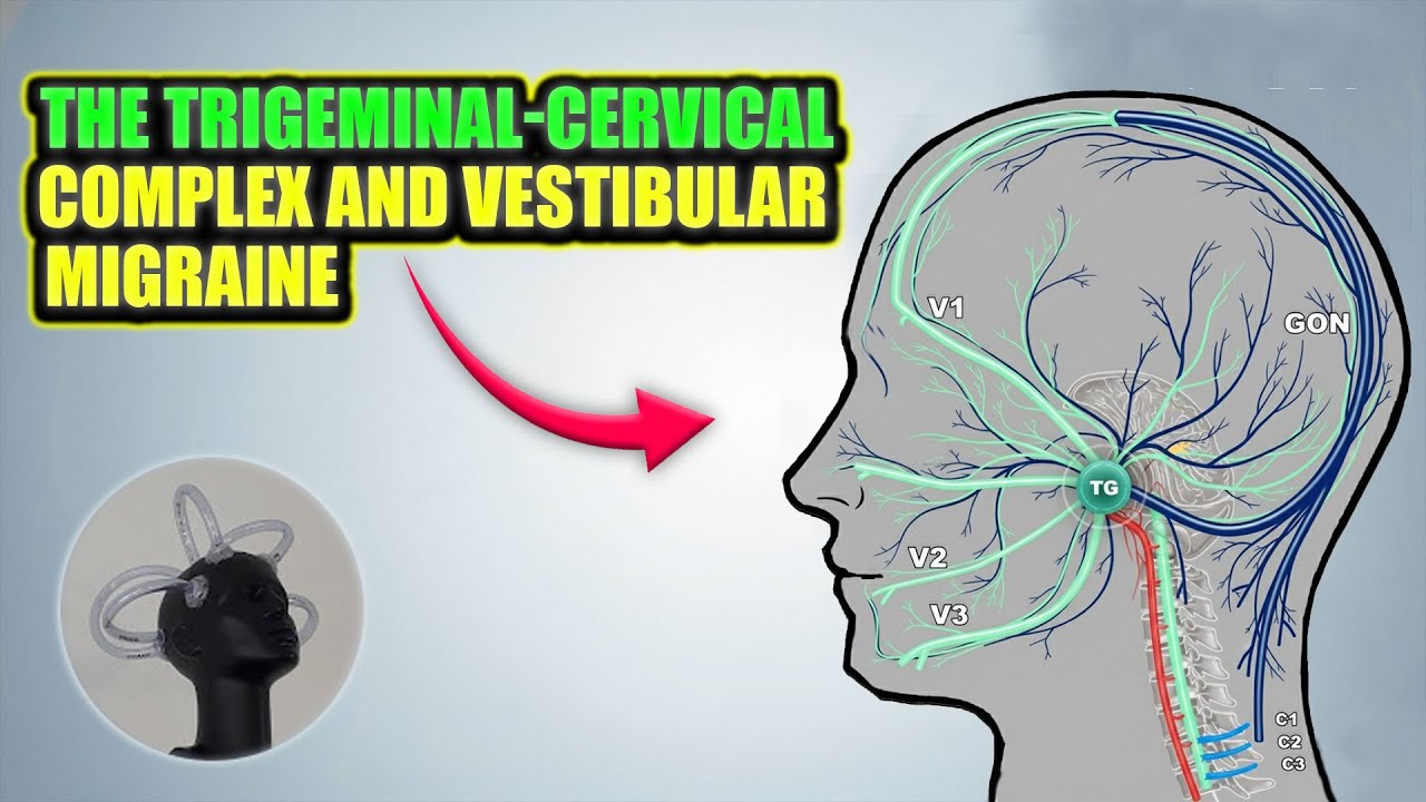 How Vestibular Migraine Works | Trigeminal Cervical System Explained | Neurotology
