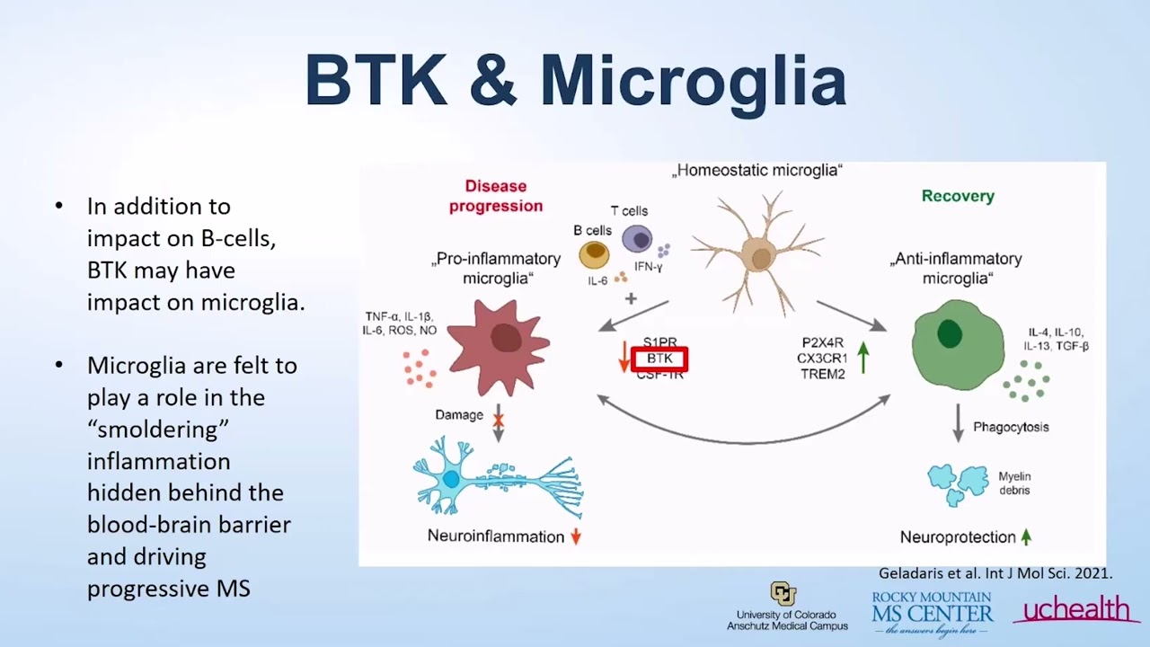 Research Update: Clinical Trials for Multiple Sclerosis