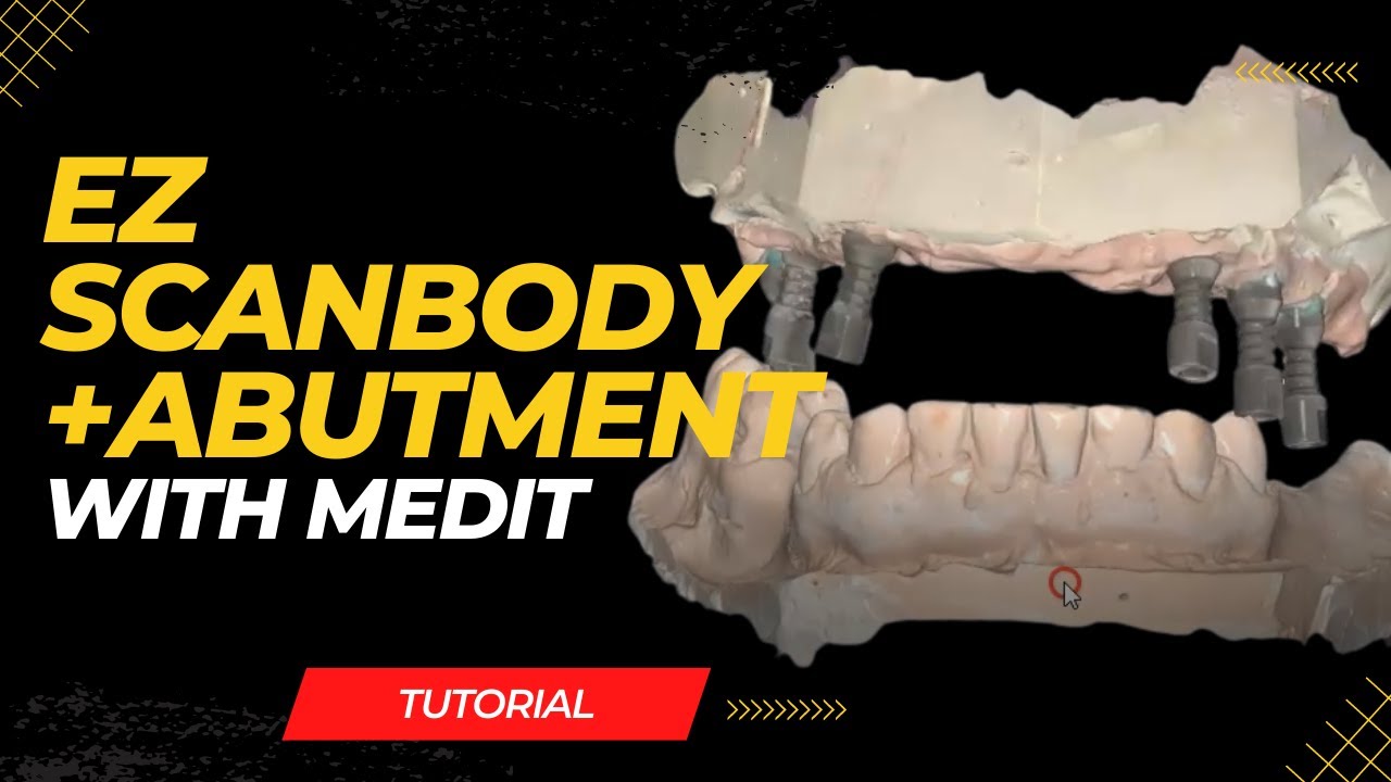 Scan an All on 4 Hybrid Denture case with EZ Scanbody + Abutment and Medit