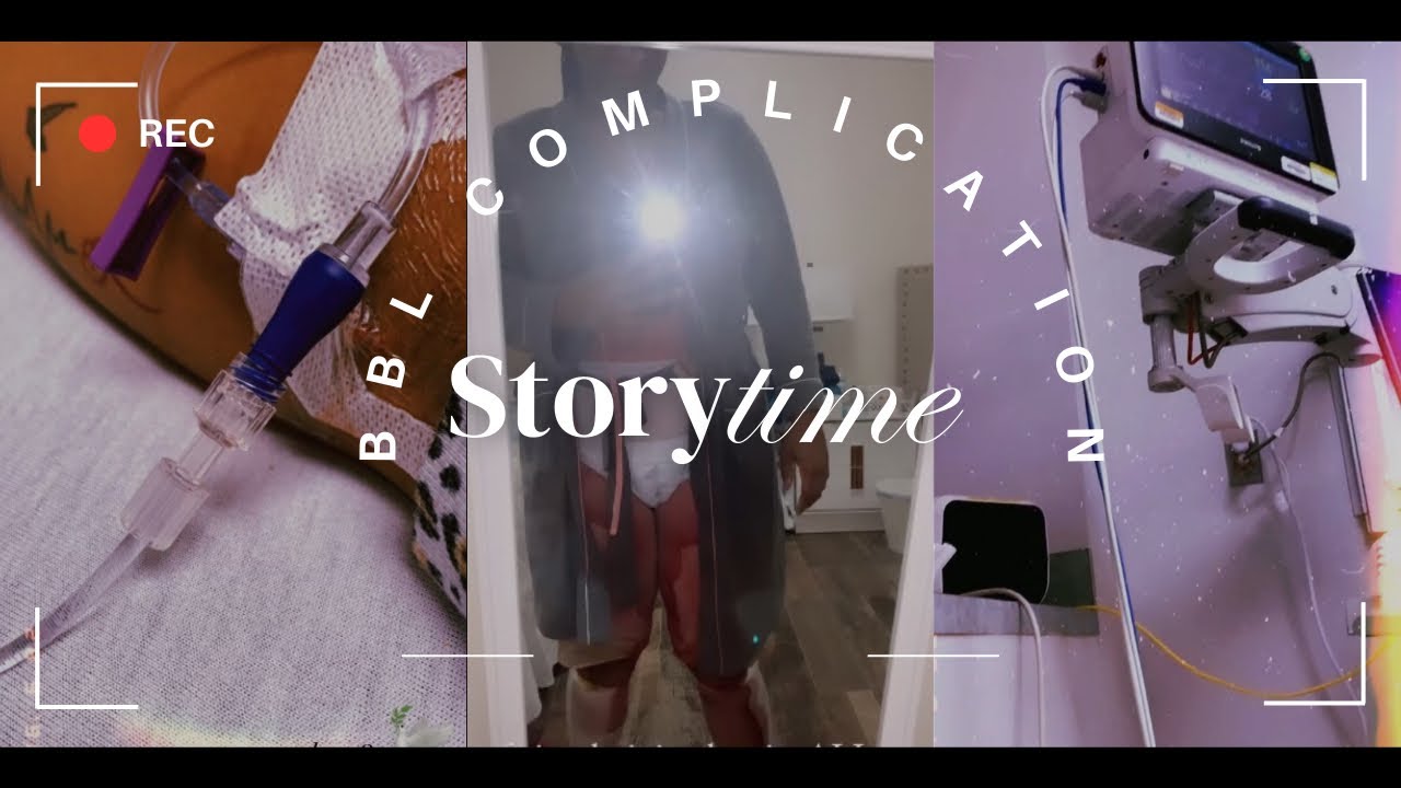 I almost DIED after BBL SURGERY …. 😢