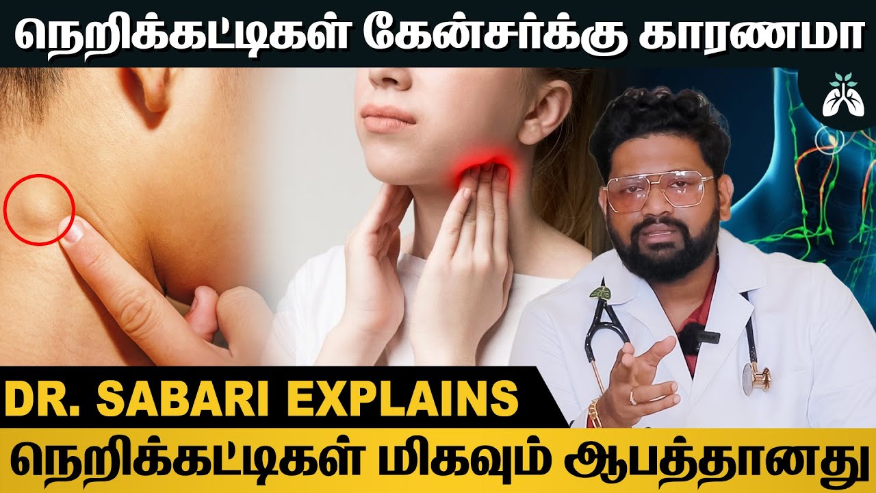 நெறிகட்டிகளுக்கான ஏற்பட இதுதான் முக்கியமான காரணம் | Dr Sabarinath Ravichandar Explains #lymphnodes