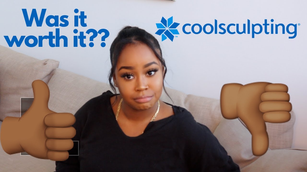 MY COOLSCULPTING EXPERIENCE | WAS IT WORTH IT? BEFORE & AFTER