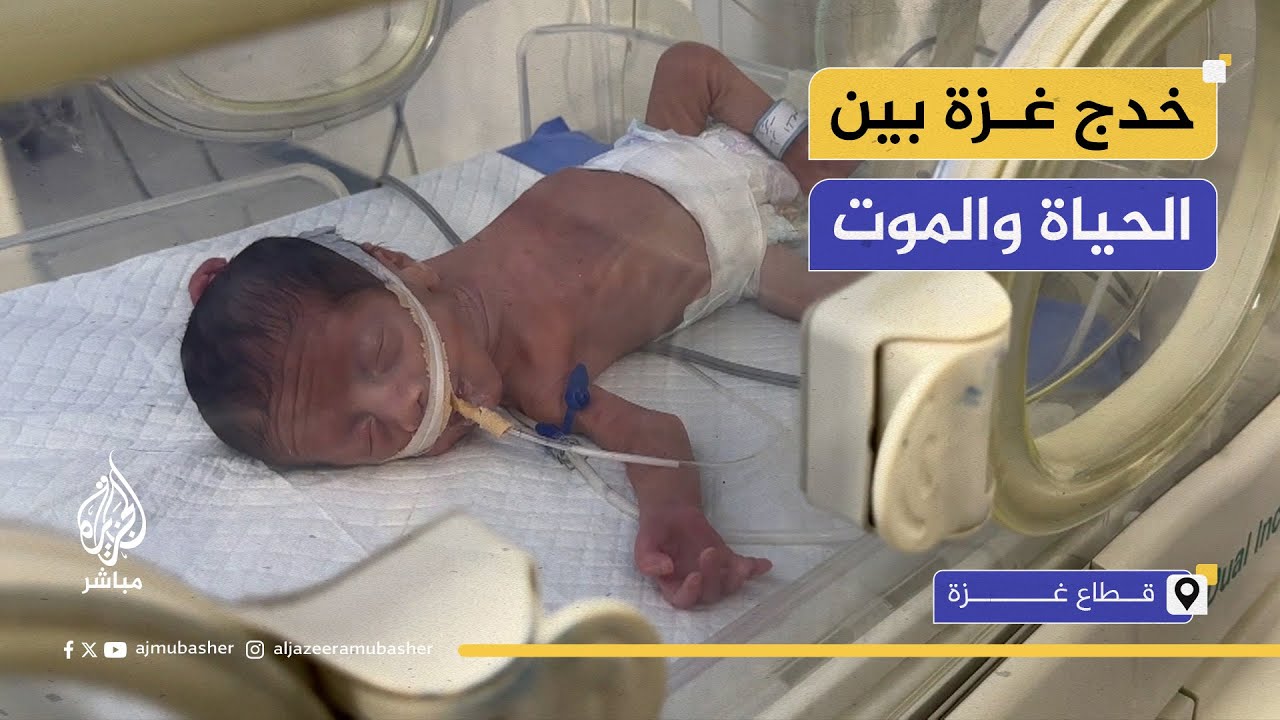 مستشفى الشفاء بغزة: قد نضطر لإعطاء الخدج جلوكوز بعد نفاد الحليب