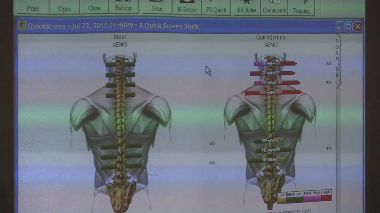 Chiropractic Adjustment, Surface EMG Scans & Spinal Alignment by Dr. Madden