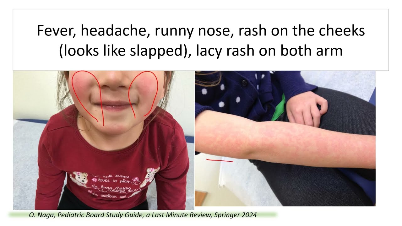 Infectious Diseases a Last-Minute Review II