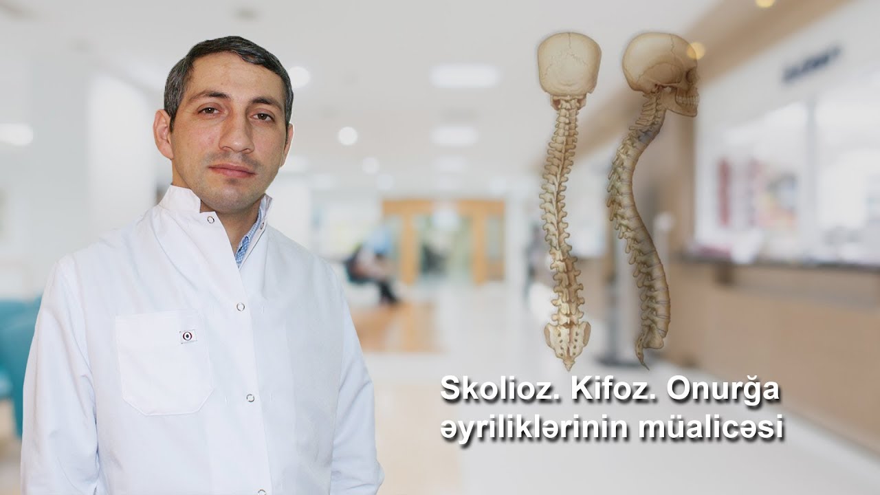 Skolioz. Kifoz. Onurğa əyriliklərinin müalicəsi - Neyrocərrah PhD Dr. Cəmil İskəndərov