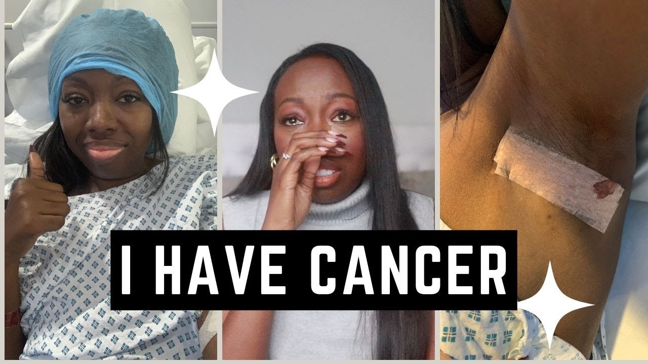 I have Cancer! | I Have Stage 2 Hodgkins Lymphoma!