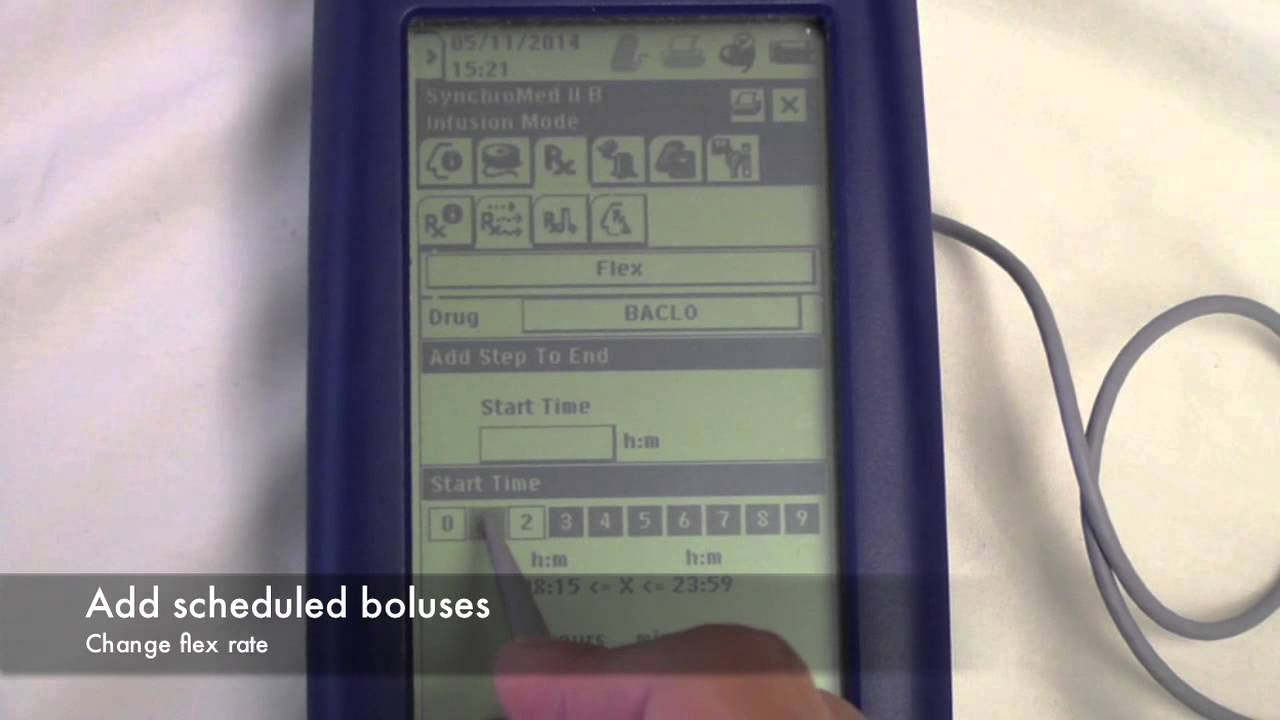 Intrathecal Baclofen Pump: Interrogation & Basic Settings