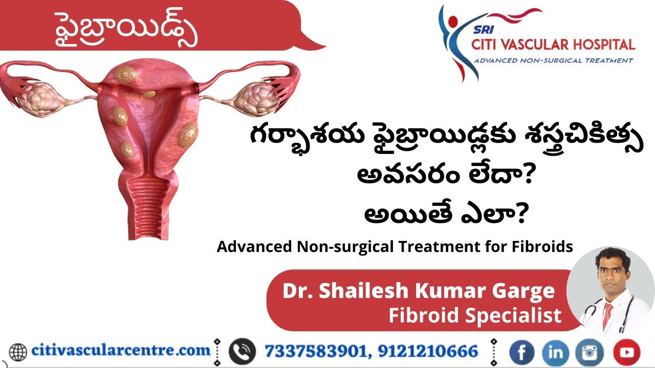 Uterine Fibroid Treatment Options in Telugu On TV5 Live | Non Surgical Fibroid Treatment