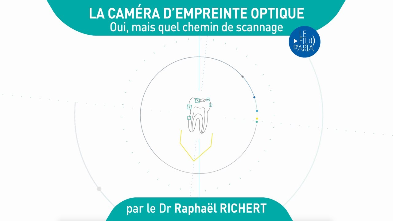 La caméra d'empreinte optique, oui, mais quel chemin de scannage ?