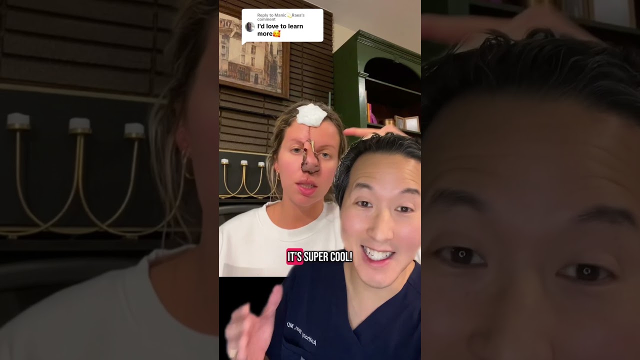 How a Forehead Flap Reconstructs the Nose!