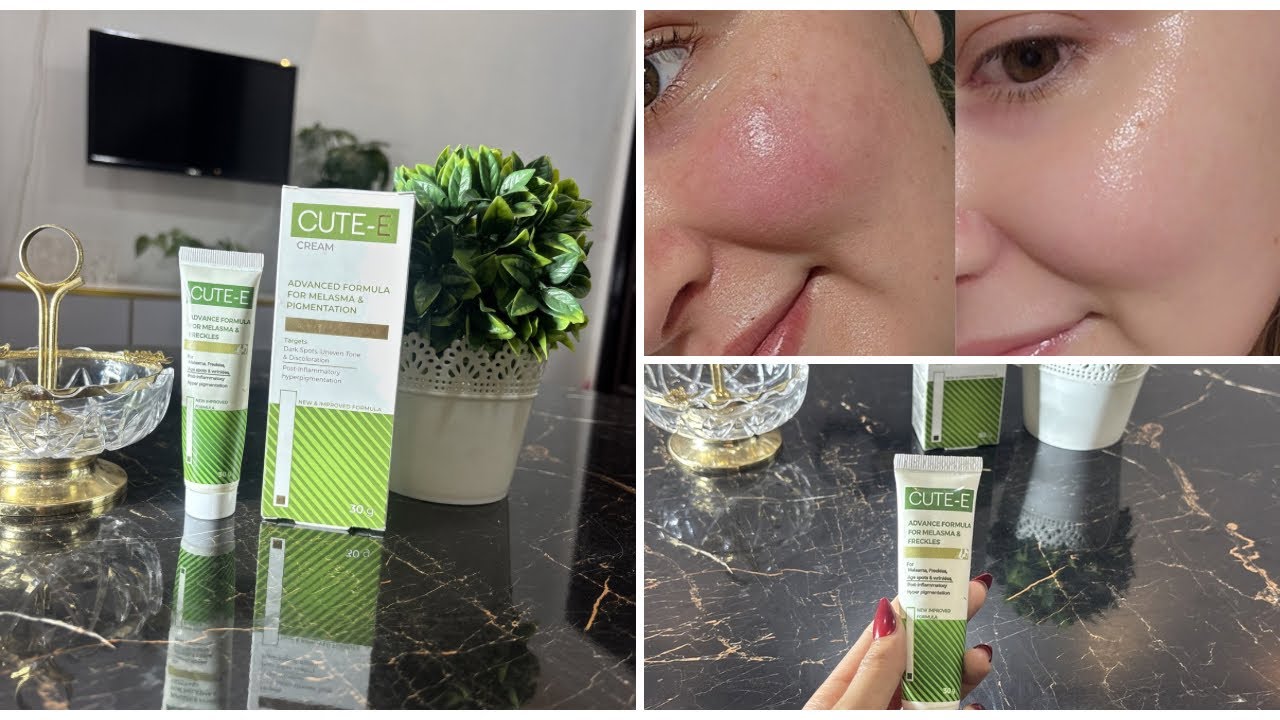 Best skin whitening MELASMA & PIGMENTATION cream 🌸