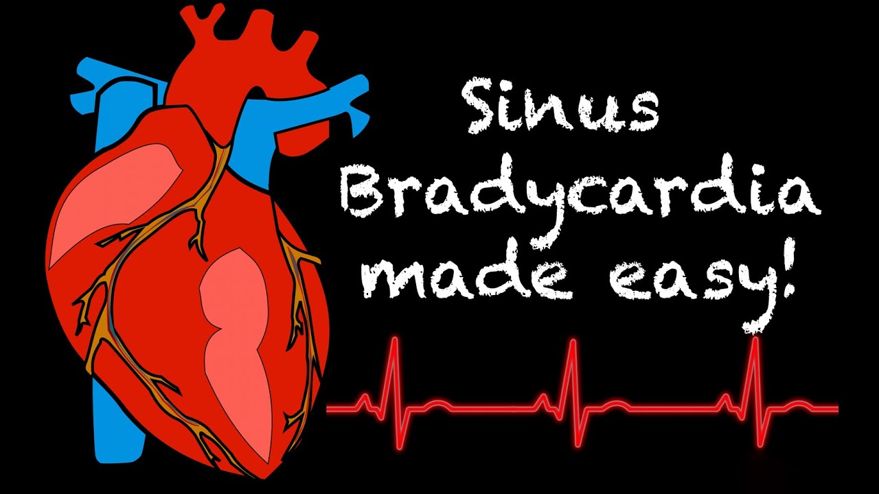 EMS Cardiology || Tachy Tuesday: Sinus Bradycardia
