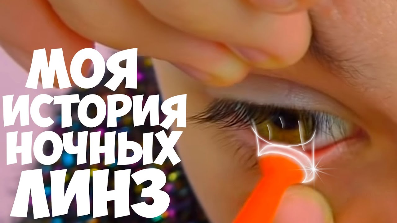 Что случилось с Глазами?  История о моём ПЛОХОМ Зрении😱