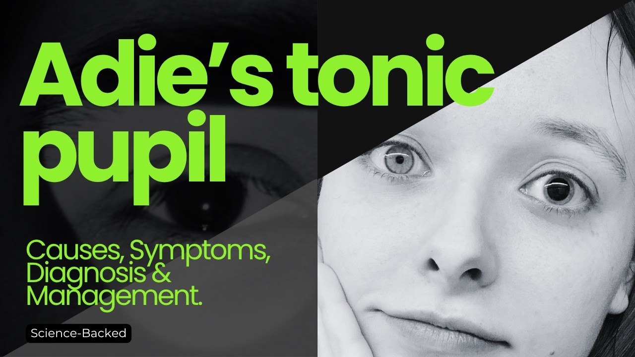 Adie's pupil - Causes, Symptoms, Diagnosis, Management.