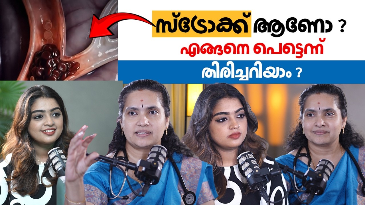 സ്ട്രോക്ക് ഈ ലക്ഷണങ്ങൾ ഒരിക്കലൂം നിസാരമാക്കരുത്  | Latest Malayalam Health Tips | Stroke