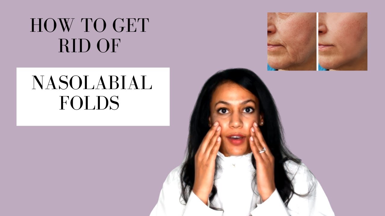 How To Get Rid of Mouth Lines - Best Nasolabial Folds Treatments