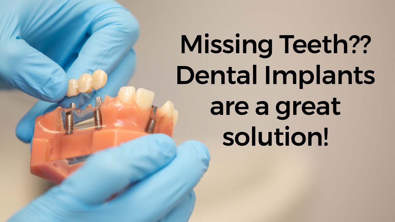 Options for replacing missing teeth.