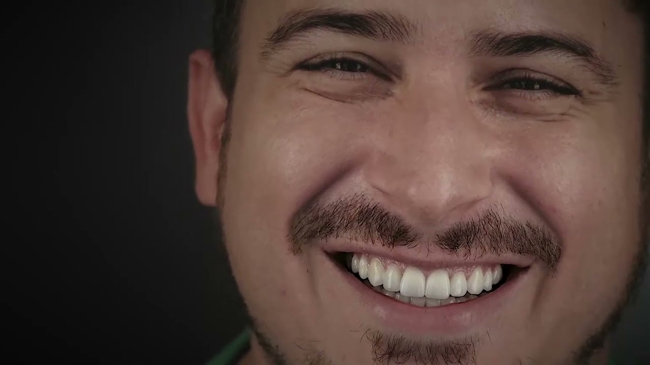 Orthodontics and dental veneers