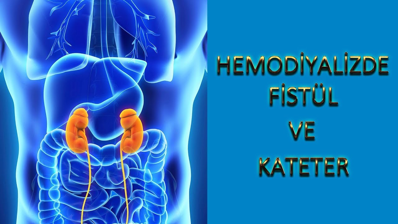 Diyaliz Fistülü ve Kateteri