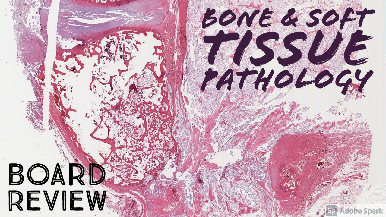 Bone & Soft Tissue Pathology Board Review: 20 Classic Cases (McGill pathology residents)