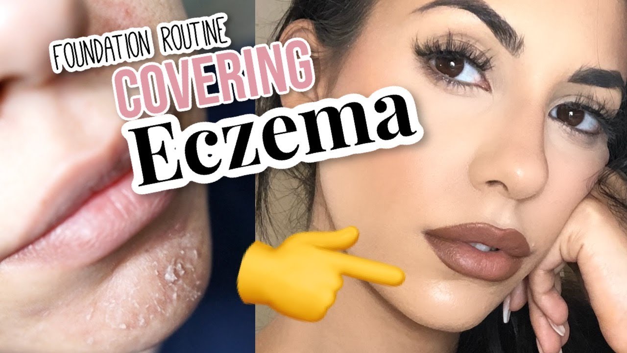 ECZEMA FOUNDATION ROUTINE | FULL COVERAGE FOR COMBO/PROBLEMATIC SKIN | Christine Lilly