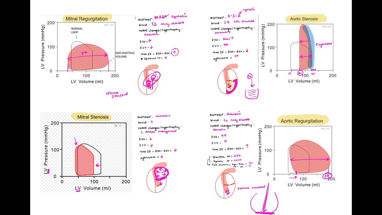 PV Loop - Cardiac physiology