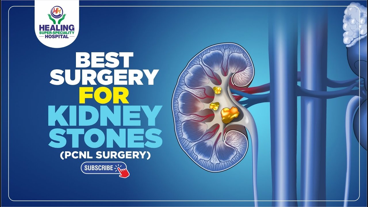 Best Hospital for Kidney Stones Surgery (PCNL) | Healing Hospital Chandigarh