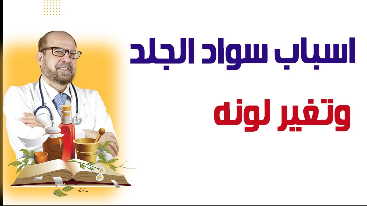 اسباب🍃 سواد الجلد🍃 وتغير لونه🍃 دكتور🍃 جودة محمد عواد