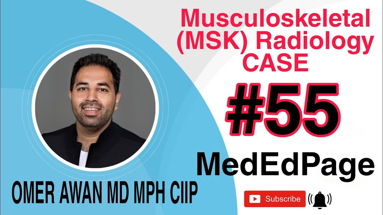 Musculoskeletal (MSK) Radiology CASE #55